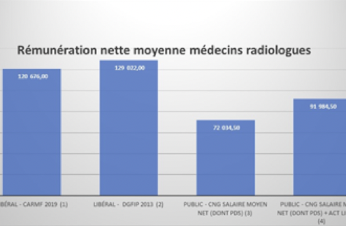 Tableau rémunération net radiologue MB rigeade Bordeaux